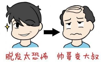 雄激素脱发加重是什么原因