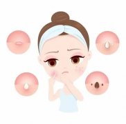 青春痘一般长到几岁