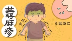 江苏省哪个医院治疗慢性荨麻疹好