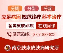 南京皮炎所五一上班嘛?