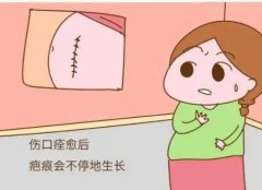南京烧伤疤痕修复哪家医院好